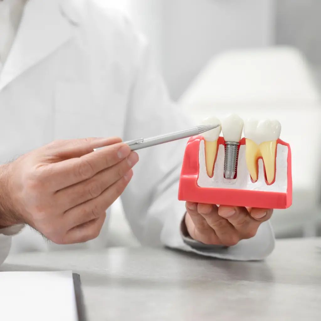 dental implants in dubai