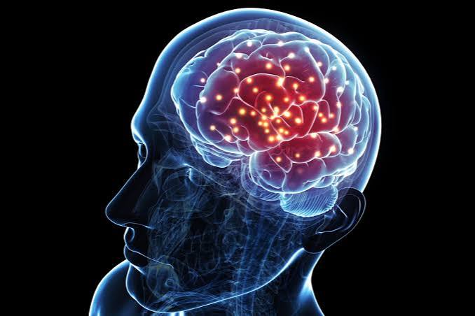 best brain hospital in Delhi